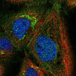 PSMG1 Antibody, Novus Biologicals 0.1mL; Unlabeled:Antibodies, Polyclonal